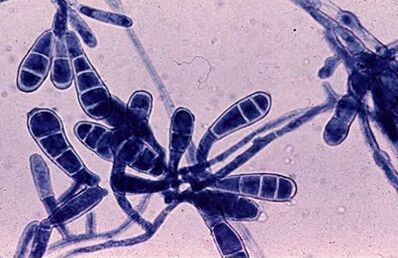 bacterias que causan fungo das uñas